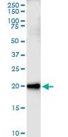 Anti-CEBPG Polyclonal Antibody Pair