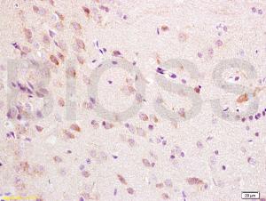 Anti-CHRM1 Rabbit Polyclonal Antibody