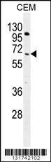 Anti-COL8A2 Rabbit Polyclonal Antibody (HRP (Horseradish Peroxidase))