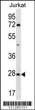 Anti-OR6T1 Rabbit Polyclonal Antibody (PE (Phycoerythrin))