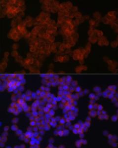 Immunofluorescence analysis of 293T cells using Anti-Axin 2 Antibody (A305285) at a dilution of 1:100 (40X lens). DAPI was used to stain the cell nuclei (blue)