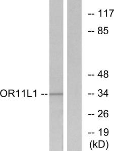 Antibody anti-OR11L1 A99540-100 100 µg