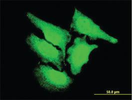 Anti-CAMK2D Mouse Monoclonal Antibody [clone: 4F9]