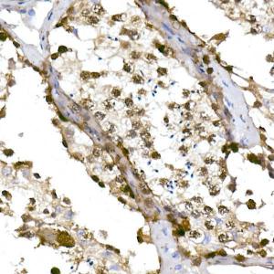 Immunohistochemistry analysis of paraffin-embedded human testis using Anti-TET1 Antibody [ARC51466] (A306210) at a dilution of 1:100 (40X lens). Perform high pressure antigen retrieval with 10 mM citrate buffer pH 6.0 before commencing with IHC staining protocol