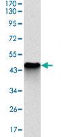 Anti-NQO1 Mouse Monoclonal Antibody [clone: 1A11]