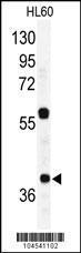 Anti-RAD23A Rabbit Polyclonal Antibody (Biotin)