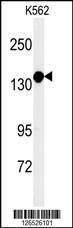 Anti-MTMRF Rabbit Polyclonal Antibody (HRP (Horseradish Peroxidase))