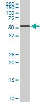 Anti-STK38 Mouse Monoclonal Antibody [clone: 6G11]