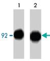 Anti-CTNNB1 Mouse Monoclonal Antibody [clone: M118]