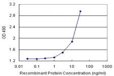 Anti-AMBP Polyclonal Antibody Pair