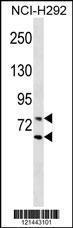 Anti-LMNA Rabbit Polyclonal Antibody (HRP (Horseradish Peroxidase))