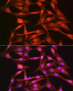 Immunofluorescence analysis of NIH/3T3 cells using Anti-Axin 2 Antibody (A305285) at a dilution of 1:100 (40X lens). DAPI was used to stain the cell nuclei (blue)