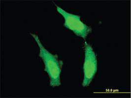 Anti-DND1 Mouse Monoclonal Antibody [clone: 3H5]