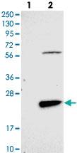 Anti-FAM167B Rabbit Polyclonal Antibody