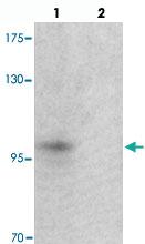 Anti-TSHZ2 Rabbit Polyclonal Antibody