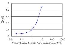 Anti-TRIM55 Polyclonal Antibody Pair