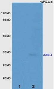 Anti-ATP1B2 Rabbit Polyclonal Antibody