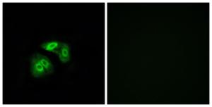 Immunofluorescence analysis of A549 cells using Anti-VN1R5 Antibody. The right hand panel represents a negative control, where the antibody was pre-incubated with the immunising peptide.