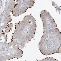 Anti-TRANK1 Rabbit Polyclonal Antibody