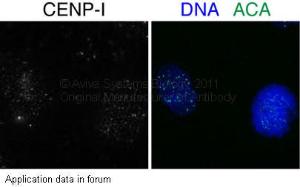 Anti-CENPI Rabbit Polyclonal Antibody