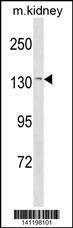 Anti-CASR Rabbit Polyclonal Antibody (HRP (Horseradish Peroxidase))