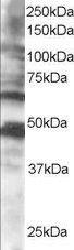 Anti-CPEB1 Antibody (A83411) staining (05 µg/ml) of human brain lysate (RIPA buffer, 35 µg total protein per lane) Primary incubated for 1 hour Detected by chemiluminescence