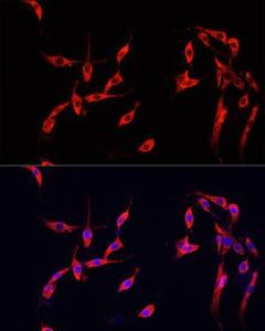 Immunofluorescence analysis of PC-12 cells using Anti-Smad2 Antibody (A93131) at a dilution of 1:100. DAPI was used to stain the cell nuclei (blue)