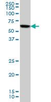 Anti-AKT1 Mouse Monoclonal Antibody [clone: 6G6]