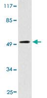 Anti-ADGRE4P Rabbit Polyclonal Antibody