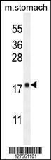 Anti-DYNLRB2 Rabbit Polyclonal Antibody (FITC (Fluorescein Isothiocyanate))