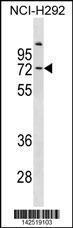 Anti-COL9A3 Rabbit Polyclonal Antibody (AP (Alkaline Phosphatase))