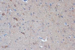 Immunohistochemistry analysis of paraffin-embedded rat brain using Anti-Raptor Antibody [ARC1375] (A309112) at a dilution of 1:100 (40X lens). Perform microwave antigen retrieval with 10 mM Tris/EDTA buffer pH 9.0 before commencing with IHC staining protocol