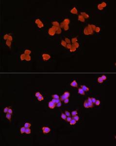 Immunofluorescence analysis of SW620 cells using Anti-Axin 2 Antibody (A305285) at a dilution of 1:100 (40X lens). DAPI was used to stain the cell nuclei (blue)