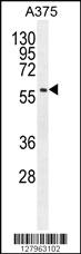 Anti-SPDYE3 Rabbit Polyclonal Antibody