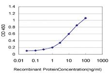 Anti-PCDH11Y Mouse Monoclonal Antibody [clone: 7D12]