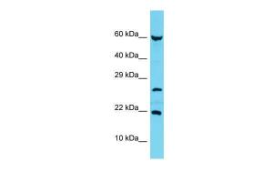 Anti-C17orf102 Rabbit Polyclonal Antibody