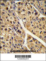 Anti-PEX11A Rabbit Polyclonal Antibody (AP (Alkaline Phosphatase))