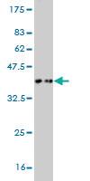 Anti-TAOK3 Mouse Monoclonal Antibody [clone: 4C12]