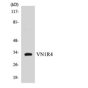 Western blot analysis of the lysates from COLO205 cells using Anti-VN1R4 Antibody