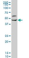 Anti-CAMK2G Mouse Polyclonal Antibody