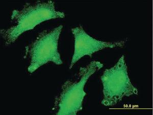 Anti-DND1 Mouse Monoclonal Antibody [clone: 1F7]