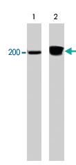 Anti-ITGB4 Mouse Monoclonal Antibody [clone: M126]