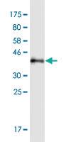 Anti-HDAC5 Mouse Monoclonal Antibody [clone: 4G2]