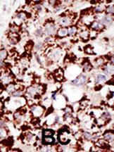 Anti-PIGK Rabbit Polyclonal Antibody (HRP (Horseradish Peroxidase))