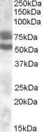 Anti-DACH1 Antibody (A83413) (0.1 µg/ml) staining of Human Kidney lysate (35 µg protein in RIPA buffer). Primary incubation was 1 hour. Detected by chemiluminescence