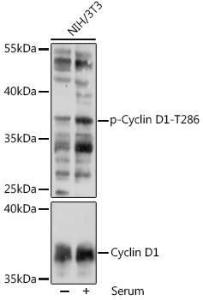 Western blot analysis of extracts of NIH/3T3 cells, using Anti-Cyclin D1 (phospho Thr286) Antibody (A305286) at 1:1,000 dilution or Cyclin D1 antibody (A11310)