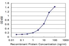 Anti-FOLR2 Mouse Monoclonal Antibody [clone: 4B12]