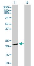 Anti-SNX12 Rabbit Polyclonal Antibody