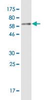 Anti-SMPD1 Mouse Monoclonal Antibody [clone: 4H2]