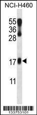 Anti-LMO2 Rabbit Polyclonal Antibody (HRP (Horseradish Peroxidase))